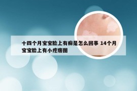 十四个月宝宝脸上有癣是怎么回事 14个月宝宝脸上有小疙瘩图