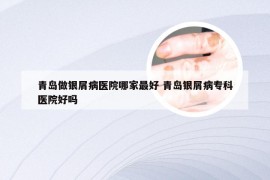 青岛做银屑病医院哪家最好 青岛银屑病专科医院好吗