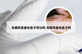 白癜风患者吃杏子可以吗 白斑风能吃杏子吗