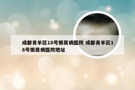 成都青羊区18号银屑病医院 成都青羊区18号银屑病医院地址