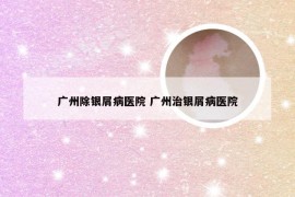 广州除银屑病医院 广州治银屑病医院