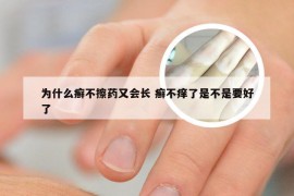 为什么癣不擦药又会长 癣不痒了是不是要好了