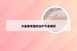 大连那家医院治疗牛皮癣好