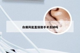 白癜风能直接做手术去掉吗
