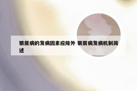 银屑病的发病因素应除外 银屑病发病机制简述