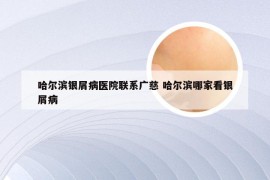 哈尔滨银屑病医院联系广慈 哈尔滨哪家看银屑病