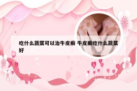 吃什么蔬菜可以治牛皮癣 牛皮廨吃什么蔬菜好