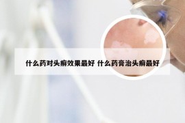 什么药对头癣效果最好 什么药膏治头癣最好