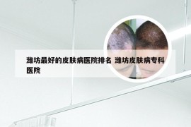 潍坊最好的皮肤病医院排名 潍坊皮肤病专科医院