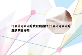 什么药可以治疗皮肤病最好 什么药可以治疗皮肤病最好用