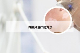 白癜风治疗的方法