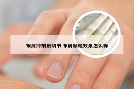 银屑冲剂说明书 银屑颗粒效果怎么样