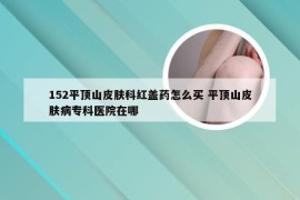 152平顶山皮肤科红盖药怎么买 平顶山皮肤病专科医院在哪
