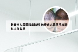 长春市人民医院皮肤科 长春市人民医院皮肤科主任名单