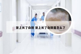 背上长了白斑 背上长了白斑是怎么了