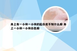 身上有一小块一小块的起白皮不知什么癣 身上一小块一小块白色癣