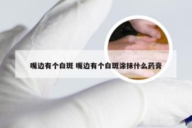 嘴边有个白斑 嘴边有个白斑涂抹什么药膏
