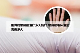 刚得的银屑病治疗多久能好 银屑病临床治愈需要多久