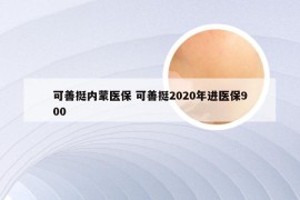 可善挺内蒙医保 可善挺2020年进医保900