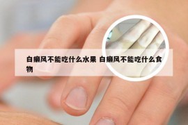 白癞风不能吃什么水果 白癞风不能吃什么食物