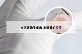 土沉香治牛皮癣 土沉香的价值