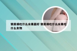 银屑病吃什么水果最好 银屑病吃什么水果吃什么食物