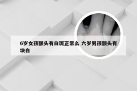 6岁女孩额头有白斑正常么 六岁男孩额头有块白
