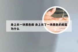 身上长一块黑色癣 身上长了一块黑色的癣是为什么