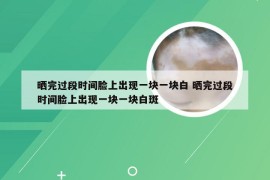 晒完过段时间脸上出现一块一块白 晒完过段时间脸上出现一块一块白斑