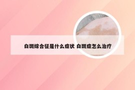 白斑综合征是什么症状 白斑症怎么治疗