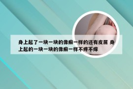 身上起了一块一块的像癣一样的还有皮屑 身上起的一块一块的像癣一样不疼不痒