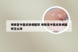 明肤堂中医皮肤病医院 明肤堂中医皮肤病医院怎么样