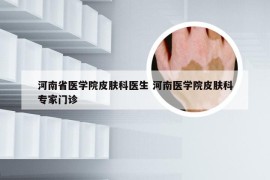 河南省医学院皮肤科医生 河南医学院皮肤科专家门诊