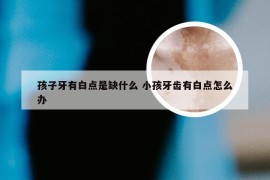 孩子牙有白点是缺什么 小孩牙齿有白点怎么办