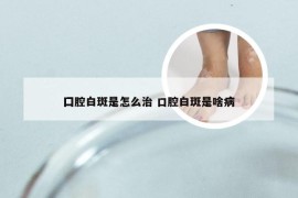 囗腔白斑是怎么治 口腔白斑是啥病