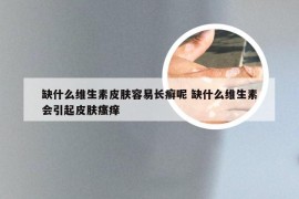 缺什么维生素皮肤容易长癣呢 缺什么维生素会引起皮肤瘙痒