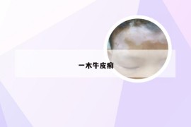 一木牛皮癣