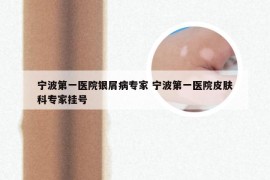 宁波第一医院银屑病专家 宁波第一医院皮肤科专家挂号
