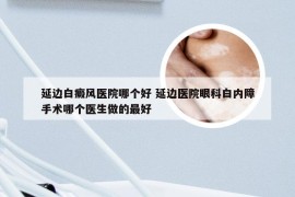 延边白癜风医院哪个好 延边医院眼科白内障手术哪个医生做的最好