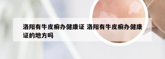 洛阳有牛皮癣办健康证 洛阳有牛皮癣办健康证的地方吗