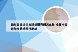 四川省四道街皮肤病研究所怎么样 成都市四道街皮肤病医院地址