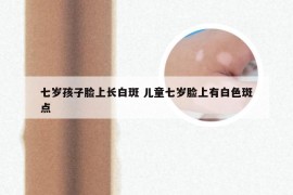 七岁孩子脸上长白斑 儿童七岁脸上有白色斑点