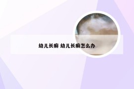 幼儿长癣 幼儿长癣怎么办