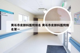 黄石市皮肤科医院排名 黄石市皮肤科医院排名第一