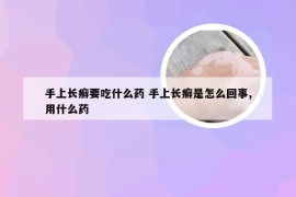 手上长癣要吃什么药 手上长癣是怎么回事,用什么药