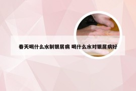 春天喝什么水制银屑病 喝什么水对银屑病好