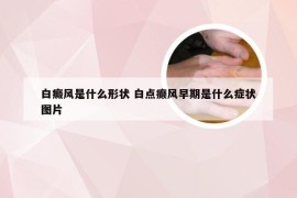 白癜风是什么形状 白点癫风早期是什么症状图片