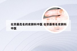 北京最出名的皮肤科中医 北京最有名皮肤科中医