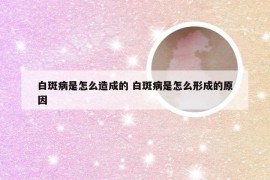 白斑病是怎么造成的 白斑病是怎么形成的原因