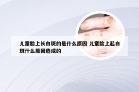 儿童脸上长白斑的是什么原因 儿童脸上起白斑什么原因造成的